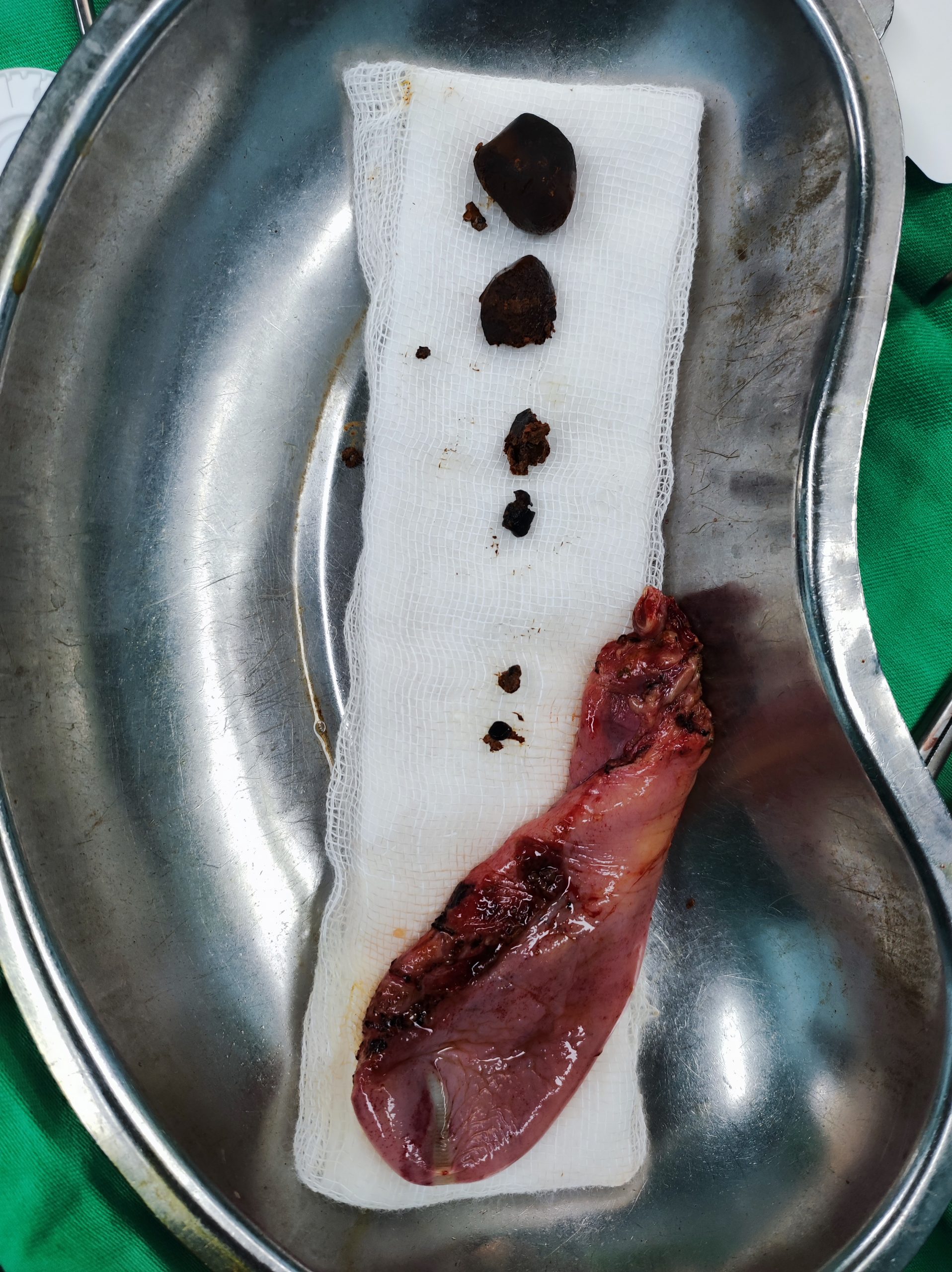 Surgery Assistance dr arefin