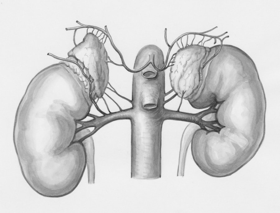 Gallbladder Removal