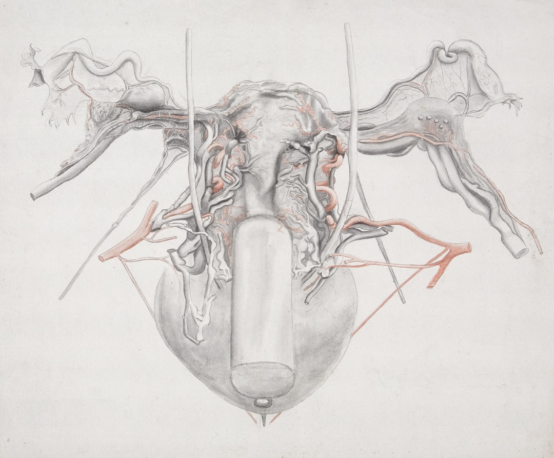 Photo Gallbladder Surgery