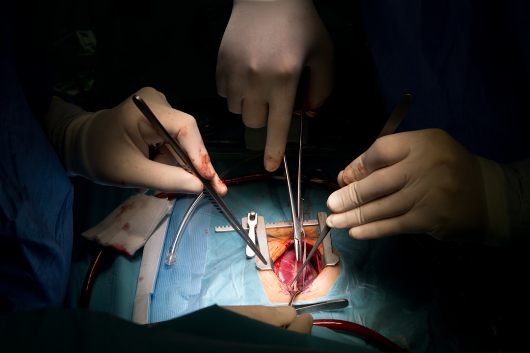 Photo Gallbladder Polyps Treatment