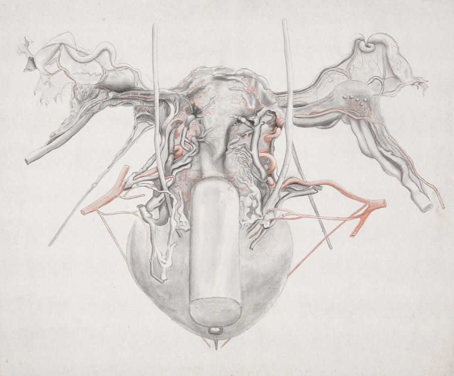 Photo Gallbladder Surgery